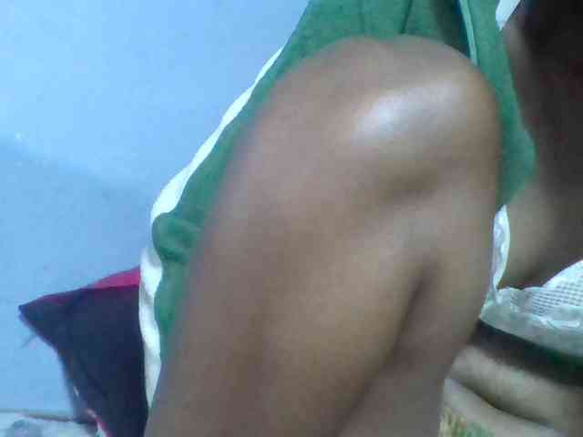 Rema-2