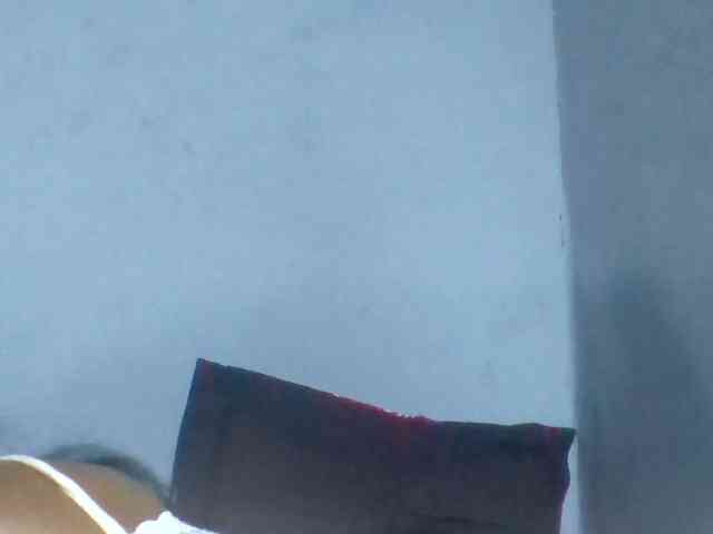 Rema-2