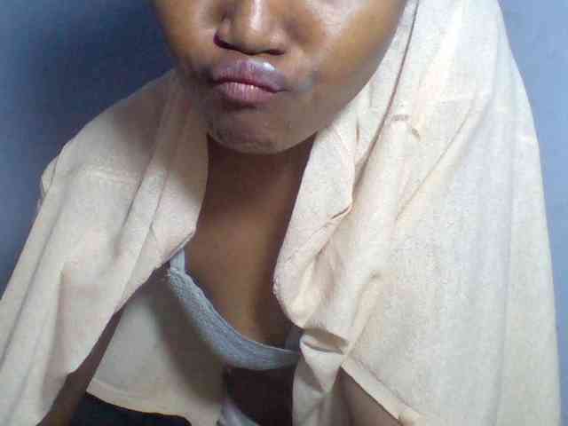 Rema-2