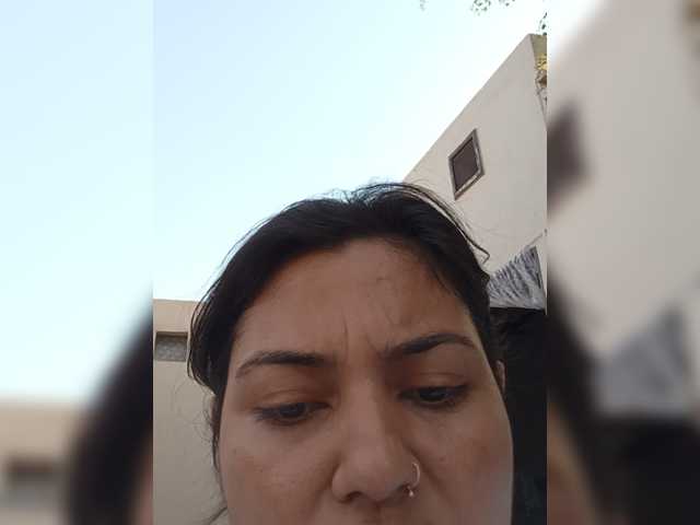 Rubella