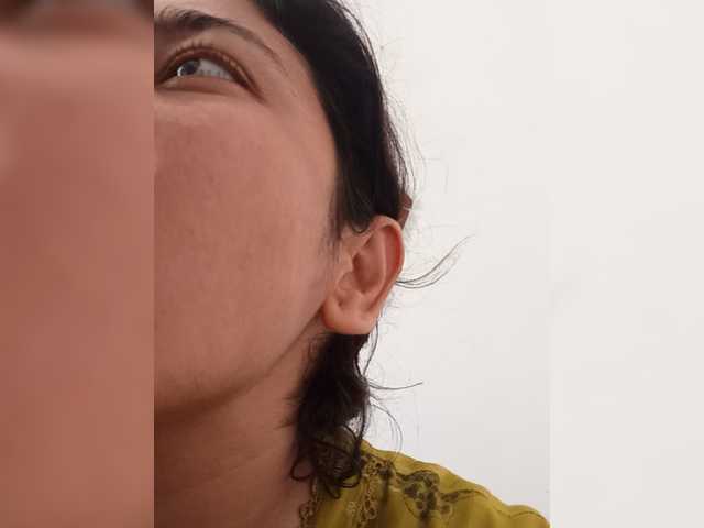 Rubella