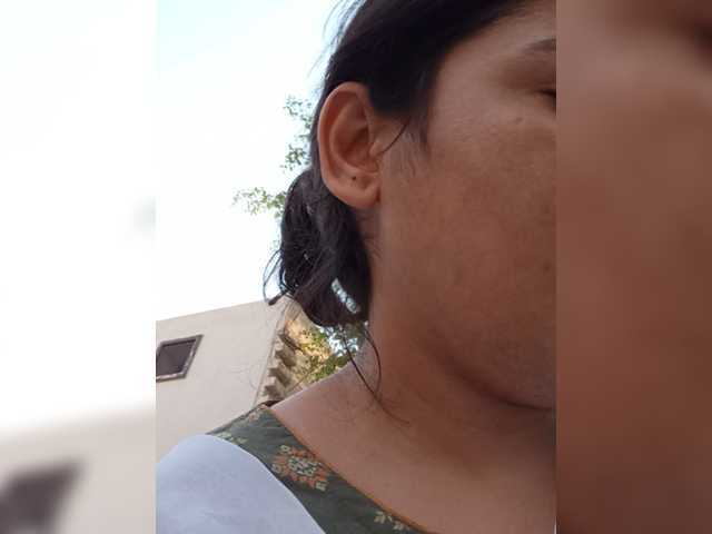 Rubella