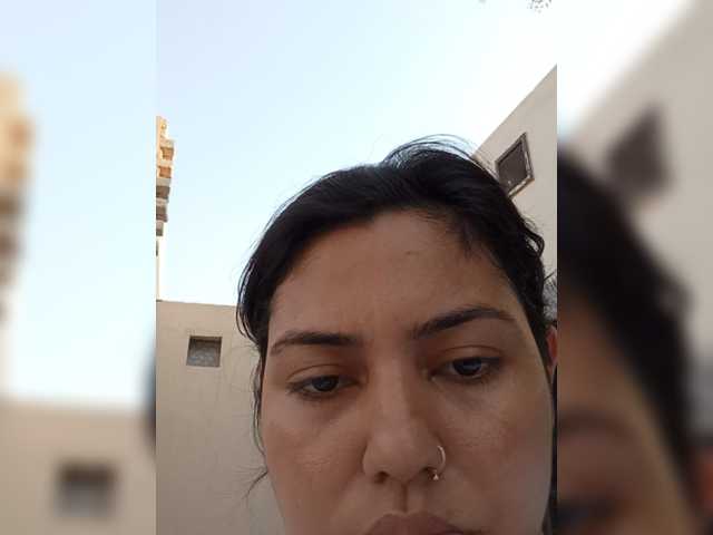 Rubella