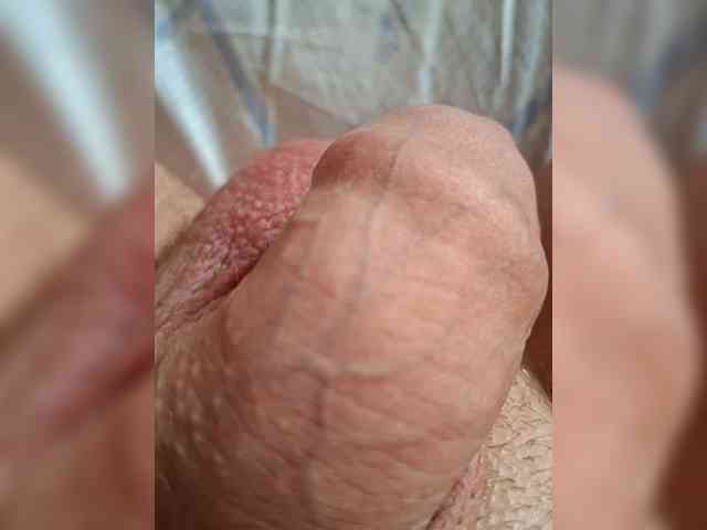 Markap