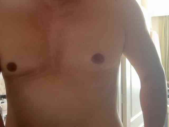 ANDREX1X