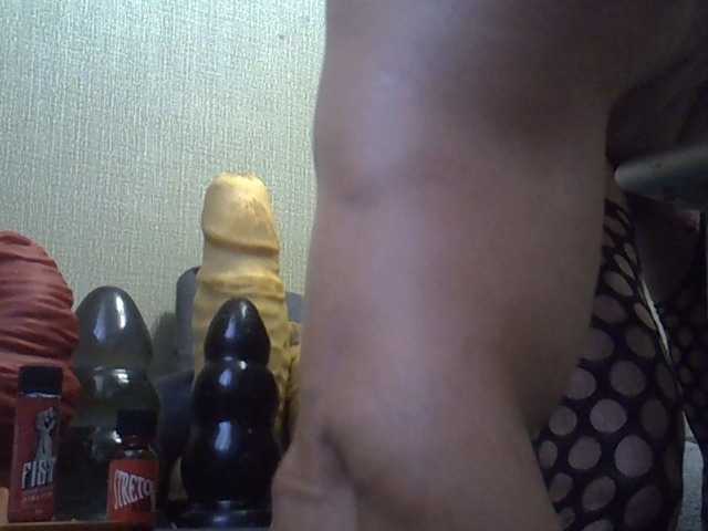FISTCAMM