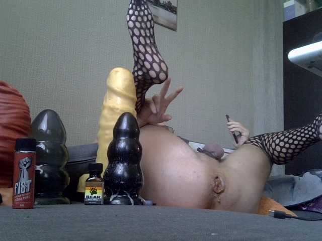 FISTCAMM