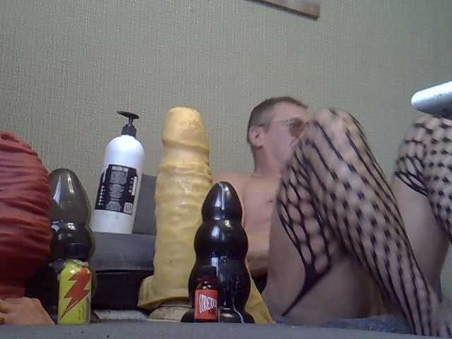 FISTCAMM