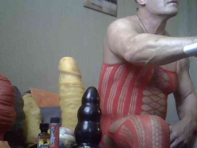 FISTCAMM FISTCAMM