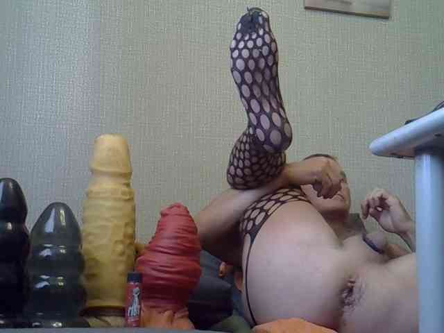 FISTCAMM
