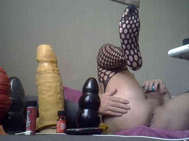 FISTCAMM