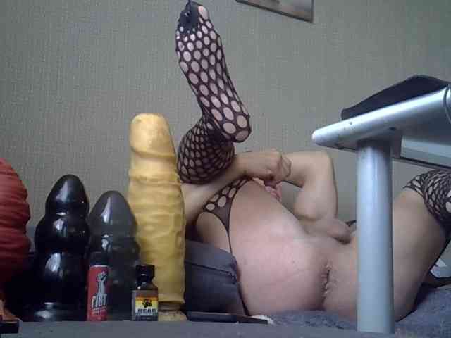 FISTCAMM