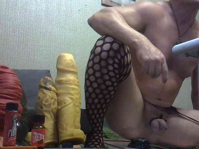 FISTCAMM