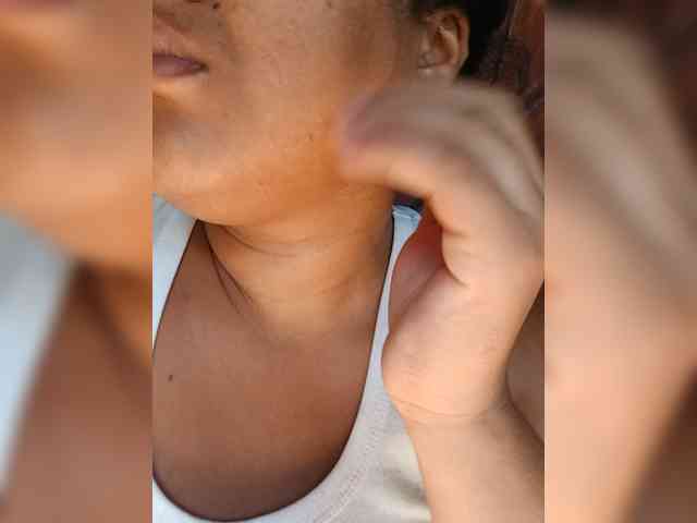 Kissled webcam