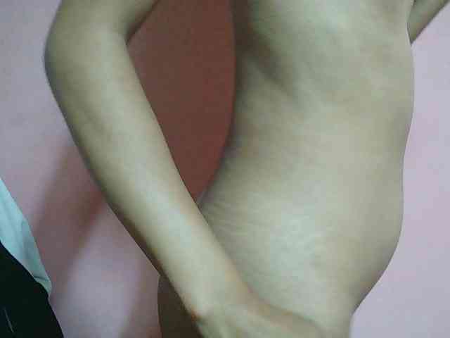 Nathie