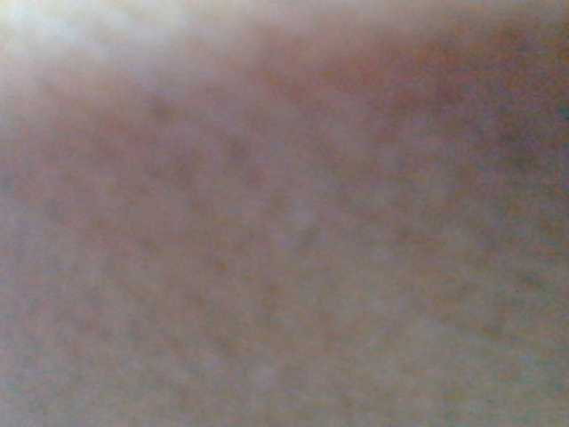 Tryciah1a