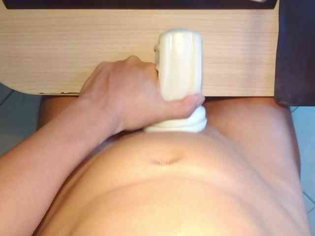expose69