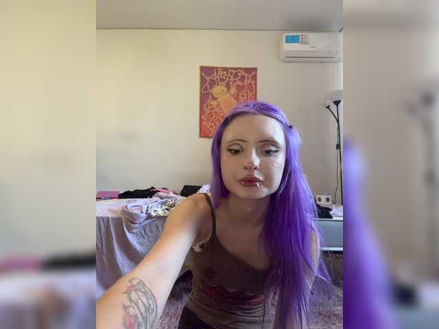 hipertoniya1