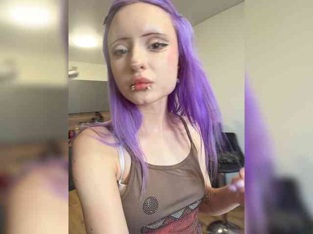 hipertoniya1 webcam