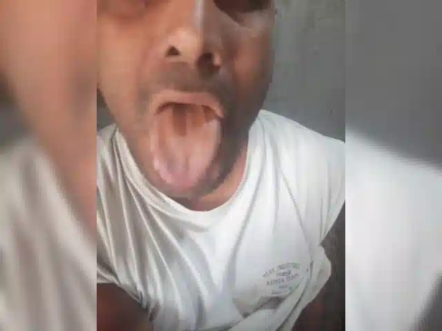 Serclem1