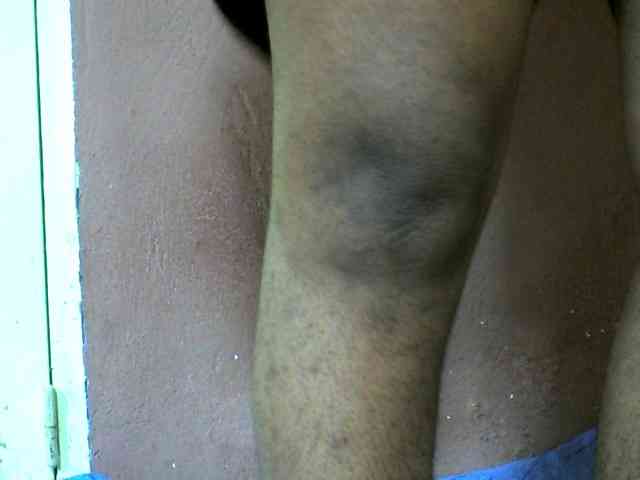 Elie2
