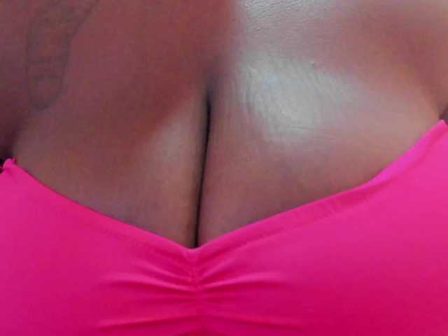 MilaBreast