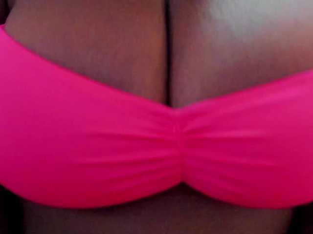 MilaBreast