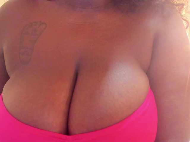 MilaBreast