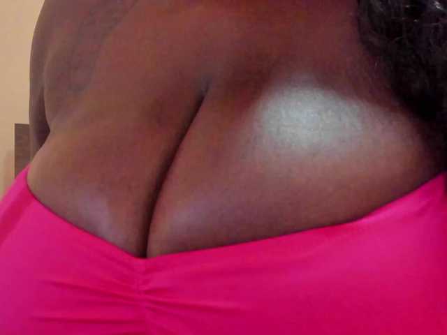 MilaBreast