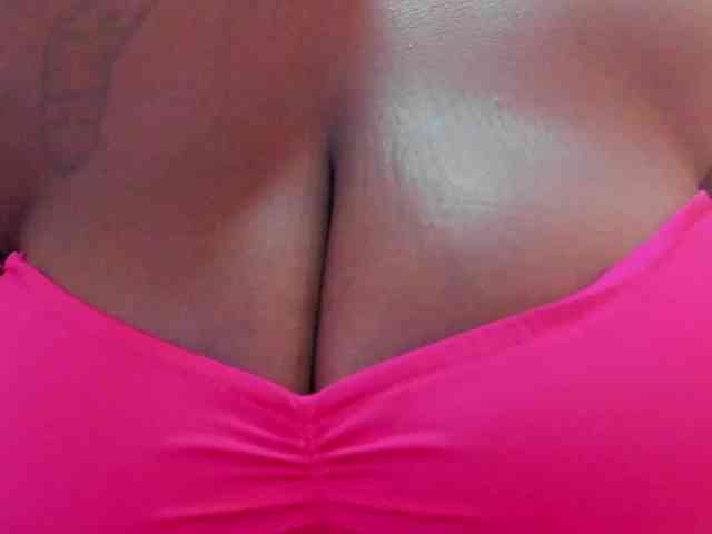MilaBreast