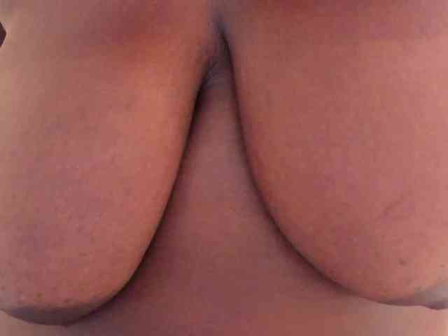 MilaBreast