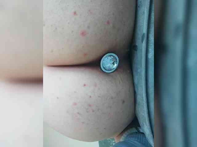 Anal-Anal