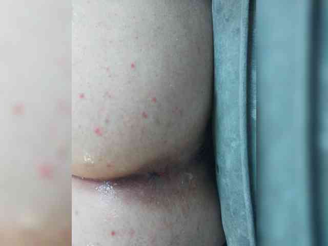 Anal-Anal