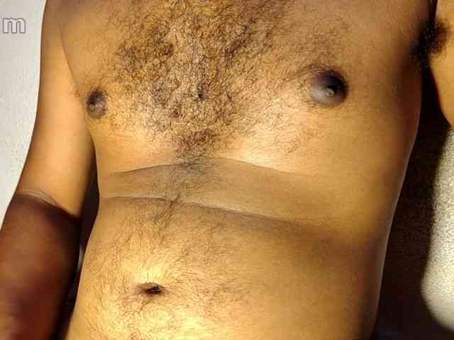 gay-hairy-teen-boy