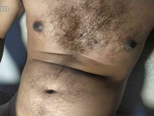 gay-hairy-teen-boy