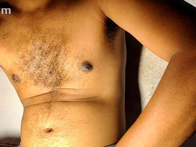gay-hairy-teen-boy