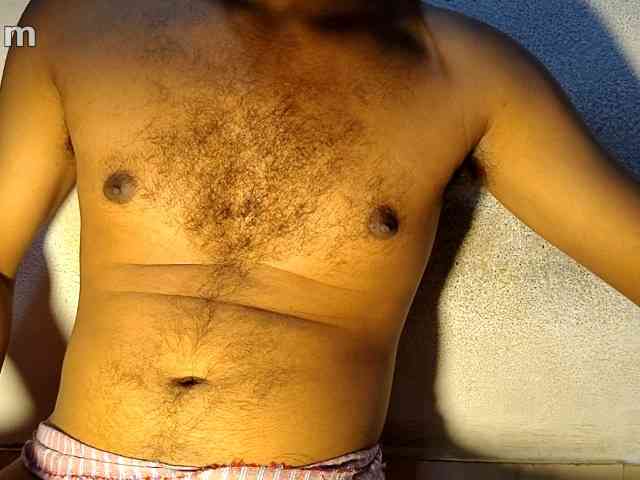 gay-hairy-teen-boy