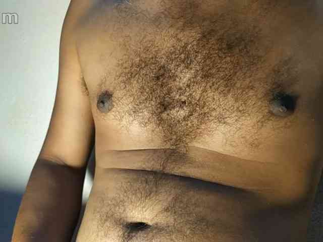 gay-hairy-teen-boy