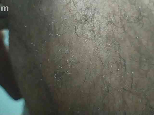 gay-hairy-teen-boy