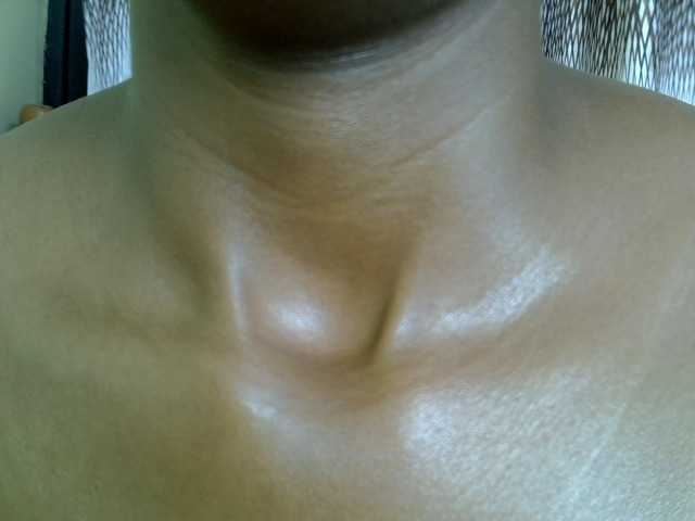 Smurfya
