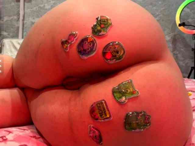 Aceass