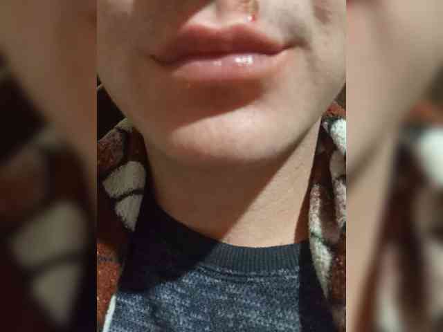 Ericc