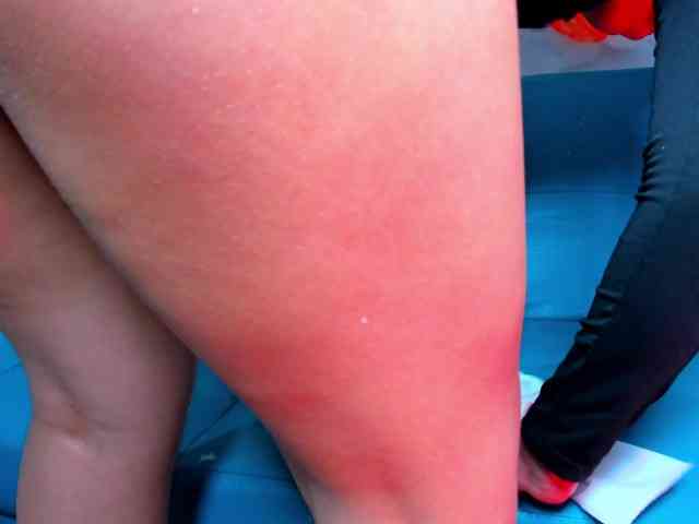 LOLIPOOPPP18