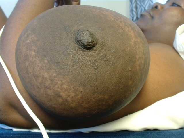 titi-fiesta