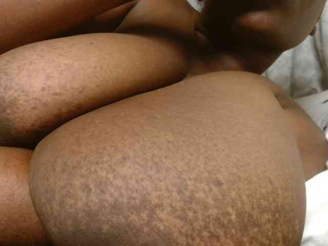 madnessalise