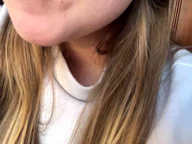 Modèle: Melodyn1