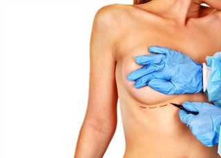my boob surgery