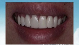 Get some teeth done