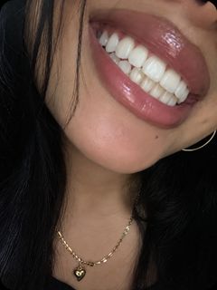 MY PERFECT SMILE ?
