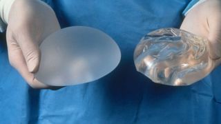 breast augmentation